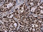 SMNDC1 Antibody in Immunohistochemistry (Paraffin) (IHC (P))