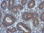 PSD Polyclonal Antibody