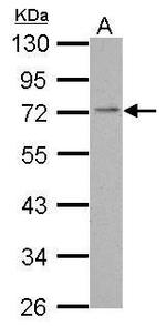 PDE4C Polyclonal Antibody