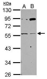 CHRNG Polyclonal Antibody