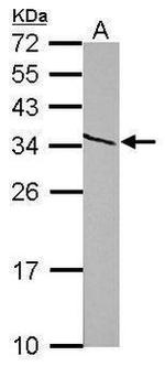 PSME3 Antibody in Western Blot (WB)