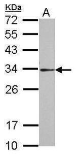 PSME3 Antibody in Western Blot (WB)