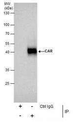 CAR Antibody in Immunoprecipitation (IP)