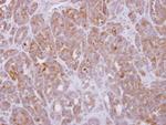 GNA15 Antibody in Immunohistochemistry (Paraffin) (IHC (P))