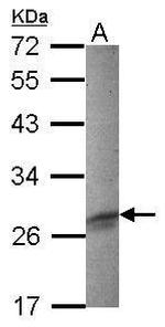 FHL3 Polyclonal Antibody