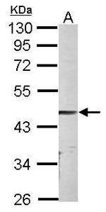 PARVA Polyclonal Antibody