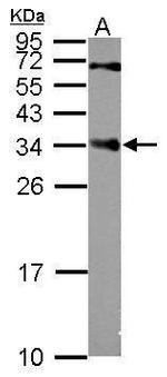 CENPP Antibody in Western Blot (WB)