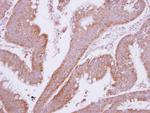 MTMR9 Polyclonal Antibody