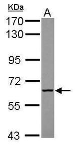 MTMR9 Antibody in Western Blot (WB)