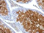 LDHAL6B Antibody in Immunohistochemistry (Paraffin) (IHC (P))