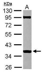 LDHAL6B Antibody in Western Blot (WB)