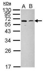MARCH5 Antibody in Western Blot (WB)