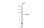 SEC24D Polyclonal Antibody