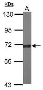 TKTL2 Polyclonal Antibody