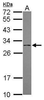 DCI Antibody in Western Blot (WB)