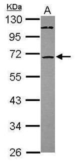 ST6GALNAC1 Polyclonal Antibody