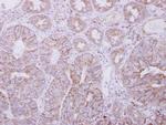 PIGO Polyclonal Antibody