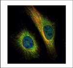 TNPO2 Polyclonal Antibody