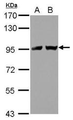TNPO2 Antibody in Western Blot (WB)