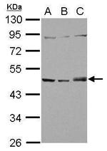 SNX5 Antibody in Western Blot (WB)