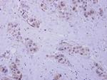 HIP55 Polyclonal Antibody