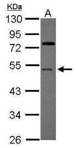 UBA5 Polyclonal Antibody