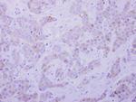 SEPT5 Polyclonal Antibody