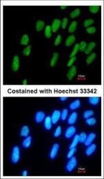 DPPA4 Antibody in Immunocytochemistry (ICC/IF)