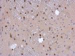 ADI1 Antibody in Immunohistochemistry (Paraffin) (IHC (P))
