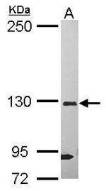 DHX37 Polyclonal Antibody