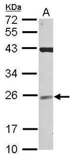 NCE2 Polyclonal Antibody
