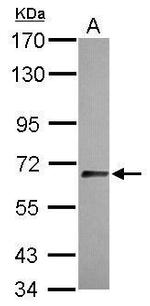 SLITRK1 Polyclonal Antibody