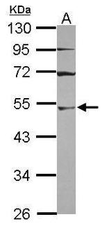 UBA3 Polyclonal Antibody