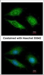 GTPBP9 Polyclonal Antibody