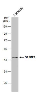GTPBP9 Antibody in Western Blot (WB)