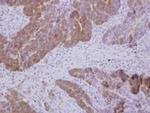 GTPBP9 Polyclonal Antibody