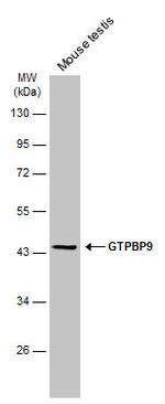 GTPBP9 Antibody in Western Blot (WB)
