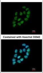 MINA53 Polyclonal Antibody