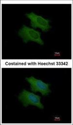 CFHR1 Polyclonal Antibody