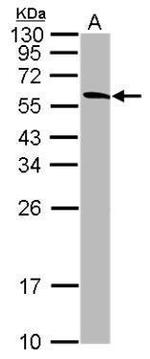 TRIM72 Polyclonal Antibody
