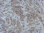 GBP5 Polyclonal Antibody