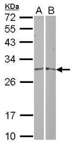MRPL19 Polyclonal Antibody