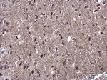 WBP11 Antibody in Immunohistochemistry (Paraffin) (IHC (P))