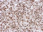 WBP11 Antibody in Immunohistochemistry (Paraffin) (IHC (P))