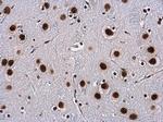 WBP11 Polyclonal Antibody