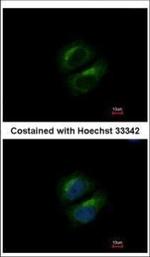 PCBP3 Polyclonal Antibody