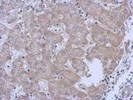 MRPL10 Polyclonal Antibody