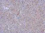MRPL10 Polyclonal Antibody
