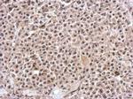 KIAA0020 Polyclonal Antibody
