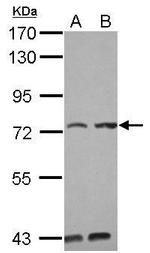 KIAA0020 Antibody in Western Blot (WB)